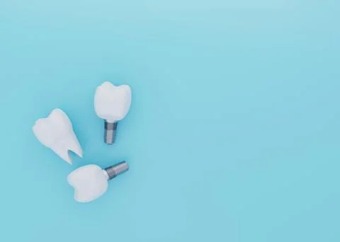 Tooth Crown and Tooth Implants on blue background with copy space, artificial Stock Illustration