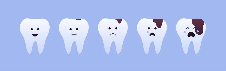 Tooth decay concept. Stages of teeth caries with face Stock Illustration