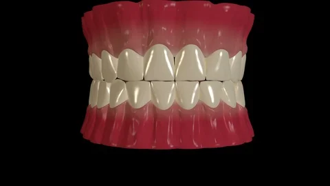 Tooth Decay Stock Footage 126814589