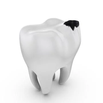 Tooth decay Illustrazione stock