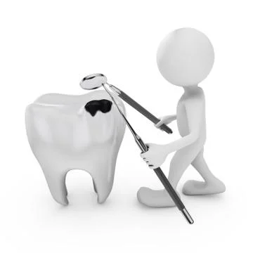 Tooth decay Illustrazione stock