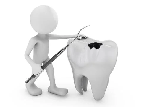 Tooth decay Illustrazione stock