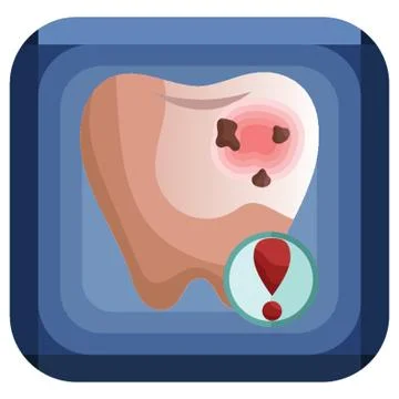 Tooth Decay Stock Illustration