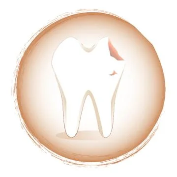 Tooth Decay Stock Illustration