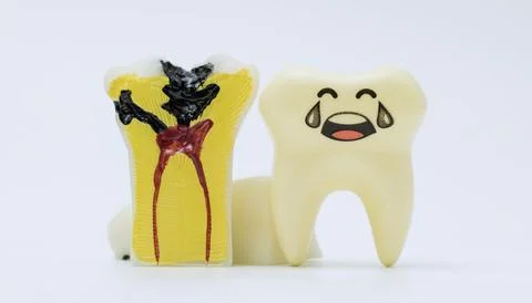 Tooth decay model with sad tooth Stock Photos