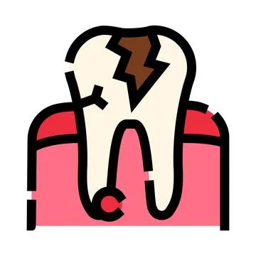 Tooth decay showing serious cavity damage and gum problem Stock Illustration