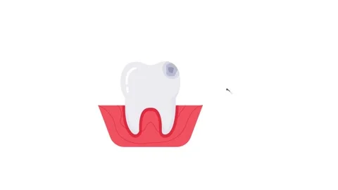Tooth Drill icon animation for video motion graphics Stock Footage 201412541
