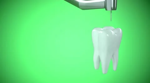 Tooth drilling Stock Footage 21705301