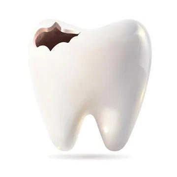 A tooth exhibiting a noticeable hole in it against a white background Stock Illustration