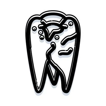 Tooth experiencing decay causing a dental cavity Stock Illustration