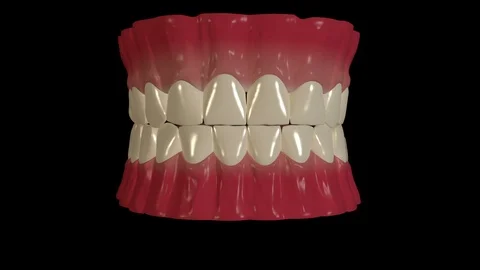 Tooth Extraction Stock-Footage 126814782