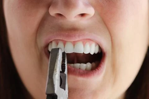 Tooth extraction Stock Photos