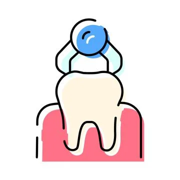 Tooth extraction process with dental forceps tool Иллюстрация