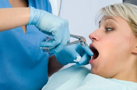 Tooth extraction, scared patient Stock Photos