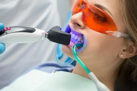 Tooth filling ultraviolet lamp Stock Photos