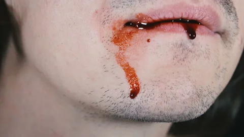 Tooth. Guy takes out a fallen tooth from his mouth Stock Footage 115365318