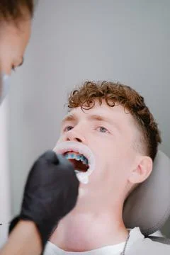 Tooth hermentation, covering the teeth with a special blue solution before in Stock-Fotos