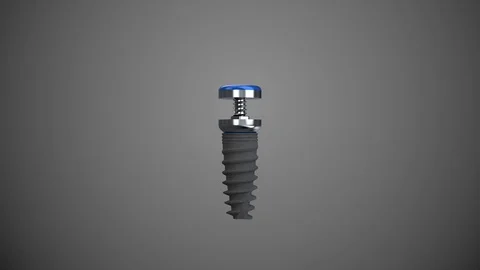 Tooth human implant Stock-Footage 122197258