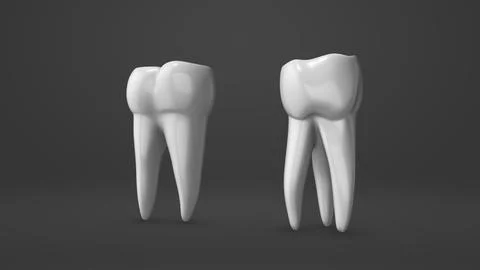 Tooth implant and crown installation process 스톡 일러스트
