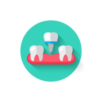 Tooth implant icon is isolated in a flat design style vector illustration Stock Illustration