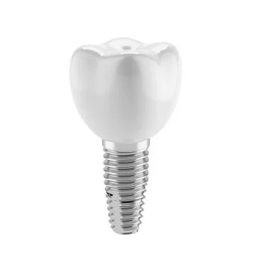 Tooth implant イラスト素材