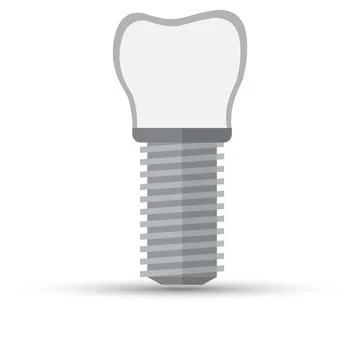 Tooth implant Stock Illustration