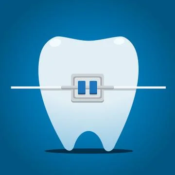 Tooth with metal braces. Isolated Vector Illustration Stock Illustration