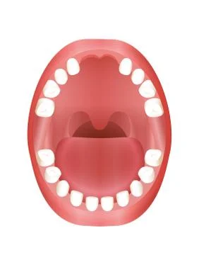 Tooth Missing Child Mouth Stock Illustration