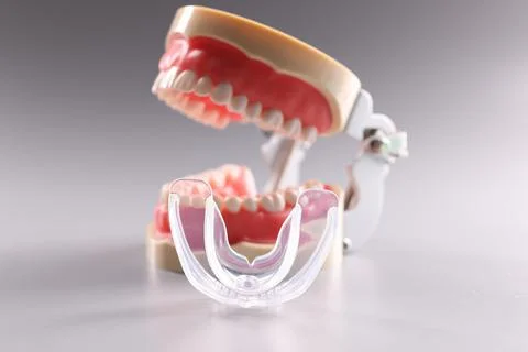 Tooth model and aligner teeth orthodontic dental model or human jaw Stock Photos