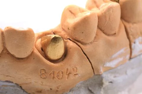 Tooth model objects from dentist school Stock Photos