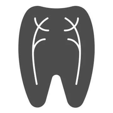 Tooth nerves solid icon. Dentist vector illustration isolated on white イラスト素材