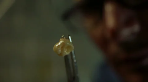 Tooth Pull Horror Stock-Footage 29290554