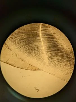 Tooth root section under microscope showing dentin tubules and cementum l Stock Photos