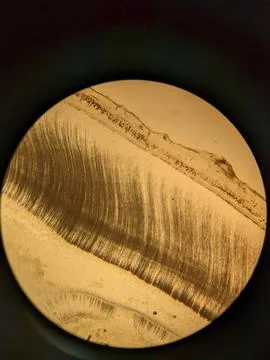 Tooth root section under microscope showing dentin tubules and cementum l Stock Photos