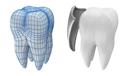 Tooth Rotation with Protection Grid and Metal Shield Stock-Footage 36610675