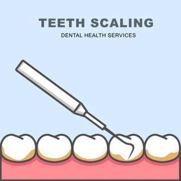 Tooth scaling icon - row of tooth, cleaning with periodontal probe Stock Illustration