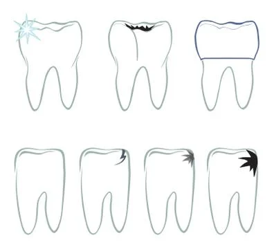 Tooth set. Teeth white sign. Dental medical isolated colection. Stock Illustration