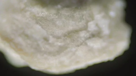 Tooth tartar sample under microscope, dental calculus macro view Stock Footage 332987248