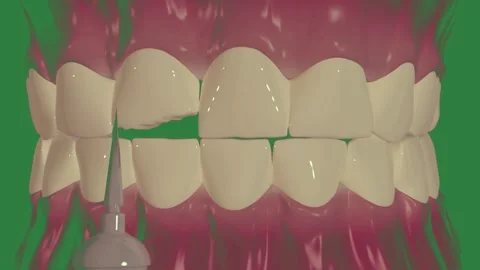 Tooth Tooth Bottle on Green Screen Background Stockbeeldmateriaal 338024011