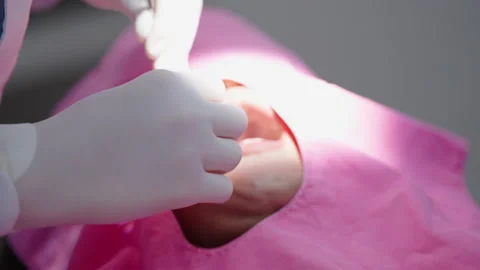 Tooth in a treatment 스톡 동영상 166963162