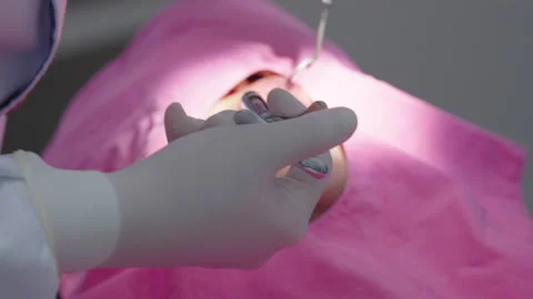 Tooth in a treatment 스톡 동영상 166963426