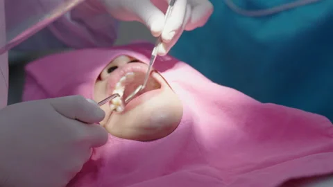 Tooth in a treatment 스톡 동영상 166963659