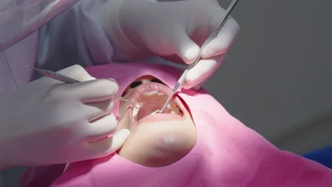 Tooth in a treatment 스톡 동영상 166964001