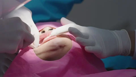 Tooth in a treatment Stock Footage 166964217