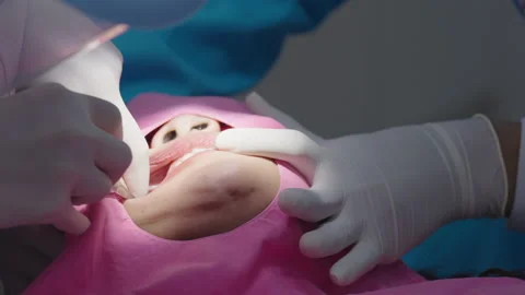 Tooth in a treatment 스톡 동영상 166964259