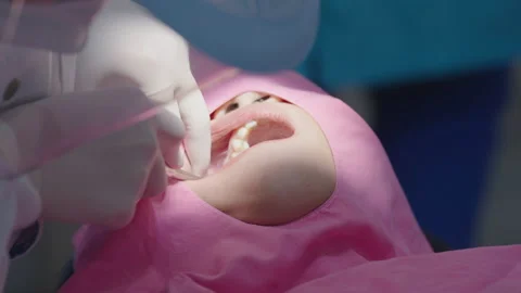 Tooth in a treatment 스톡 동영상 166964353