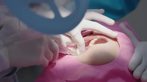 Tooth in a treatment 스톡 동영상 166964481