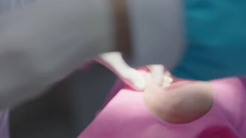 Tooth in a treatment 스톡 동영상 166964573