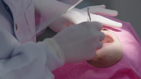 Tooth in a treatment 스톡 동영상 166964631