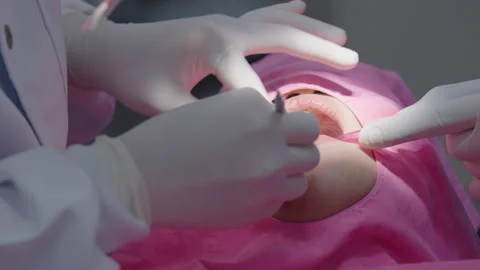 Tooth in a treatment 스톡 동영상 166964906